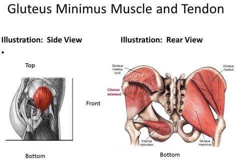 test for glut med tear l|gluteus medius diagnosis.